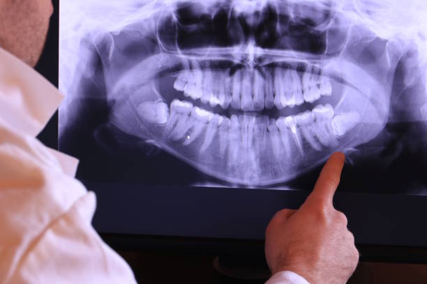 Best Same-Day Emergency Dentist in Pasatiempo, CA